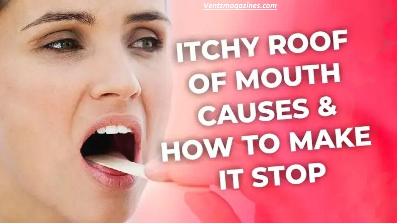 Why Does the Roof of My Mouth Hurt? Top Causes Explained