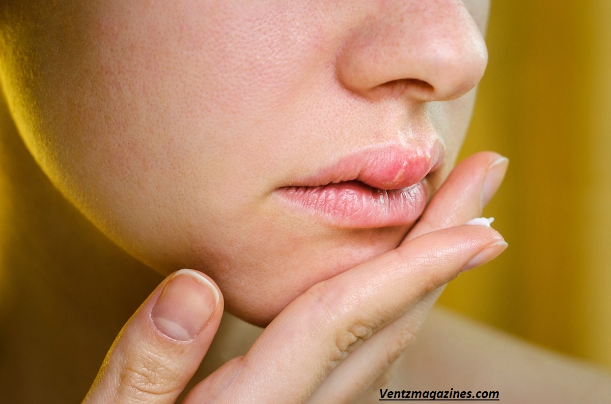 Why Is My Lip Swollen on One Side? Causes & Fixes