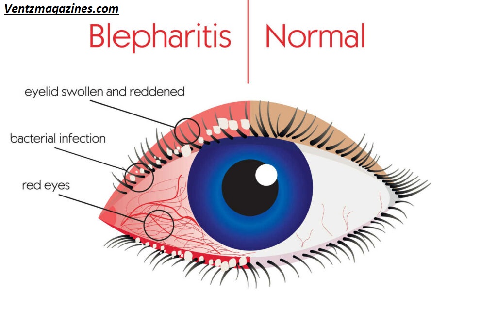 Why Are My Eyes Burning All of a Sudden? Causes & Quick Fixes Explained