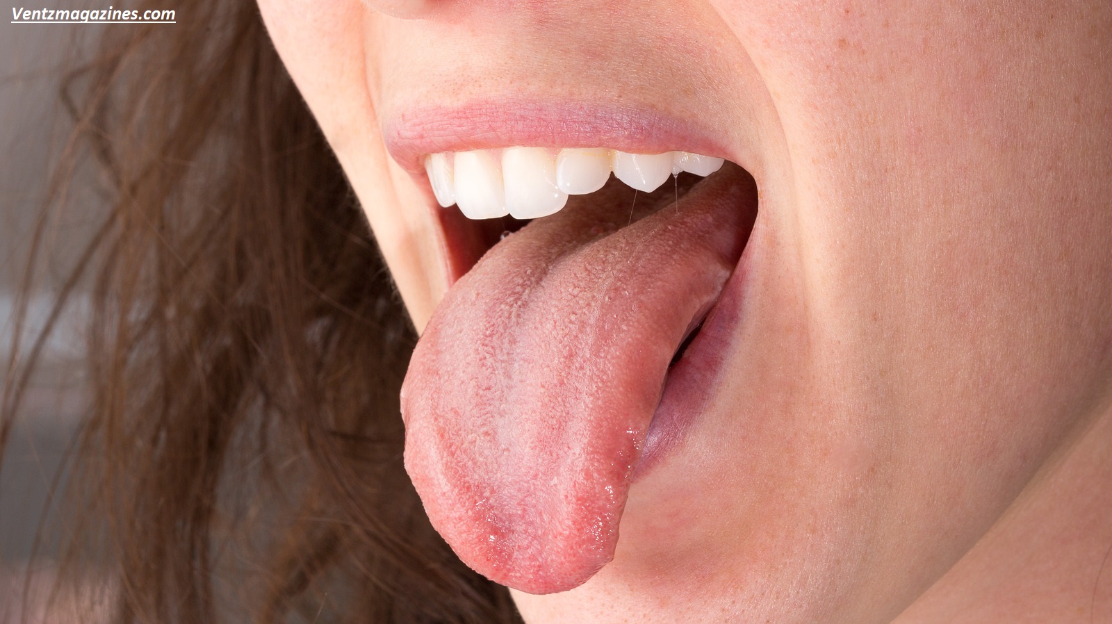Why Is My Tongue Sore? Causes & Easy Fixes