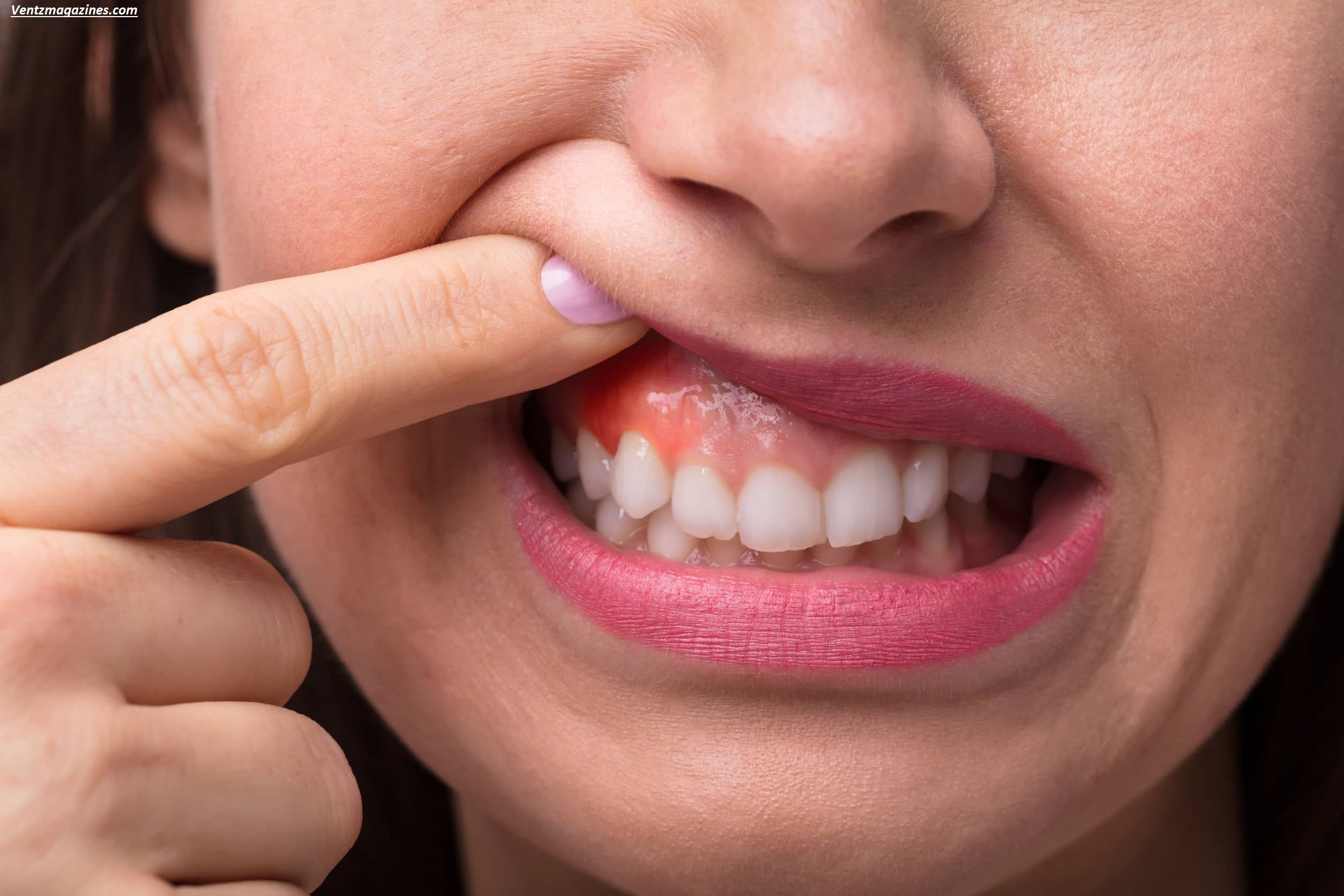 Why Do My Gums Hurt in One Spot? Causes, Treatments & When to See a Dentist